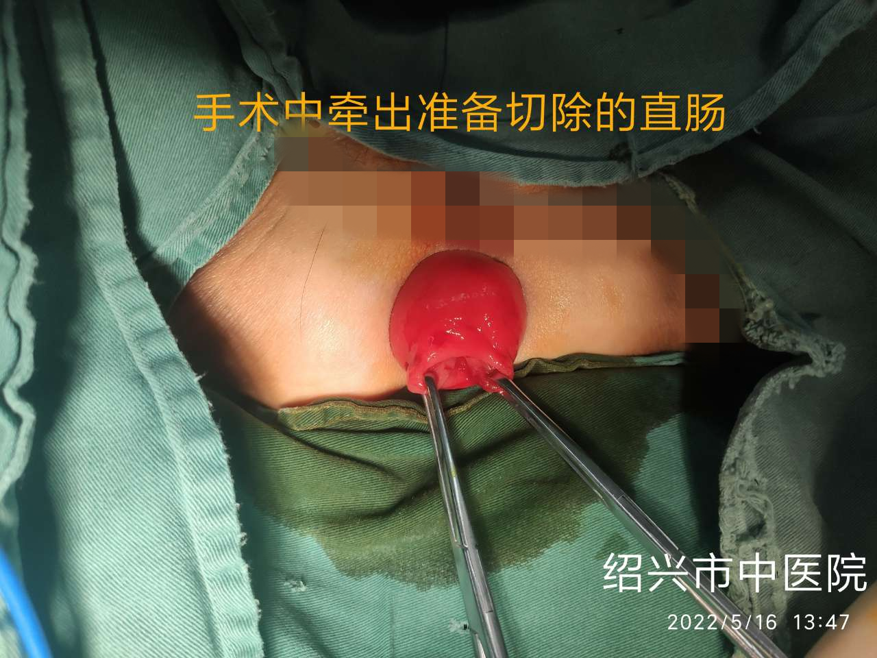 图片 3.png